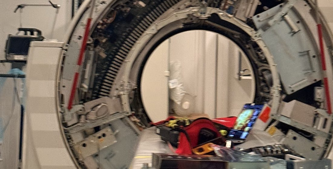 Inside an open Siemens CT gantry during a detector-module replacement